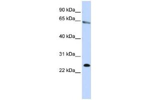 Western Blotting (WB) image for anti-Zinc Finger Protein 326 (ZNF326) antibody (ABIN2458467) (ZNF326 抗体)