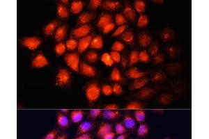 Immunofluorescence analysis of HeLa cells using IGF2 Polyclonal Antibody at dilution of 1:100 (40x lens). (IGF2 抗体)