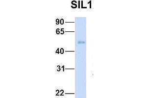 Western Blotting (WB) image for anti-Nucleotide Exchange Factor SIL1 (SIL1) (C-Term) antibody (ABIN2782037)