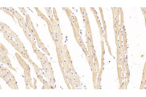 Immunohistochemistry (IHC) image for anti-Hemoglobin beta (HBB) (AA 1-147) antibody (ABIN7437341)