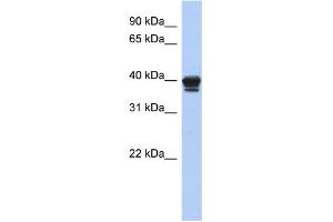 WB Suggested Anti-NAPE-PLD Antibody Titration: 0.