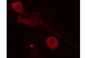 ABIN6275999 staining  COLO205 cells by IF/ICC. (Glucagon Receptor 抗体  (Internal Region))