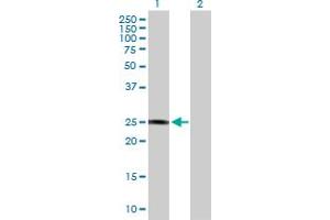 Western Blot analysis of GSTZ1 expression in transfected 293T cell line by GSTZ1 MaxPab polyclonal antibody. (GSTZ1 抗体  (AA 1-216))