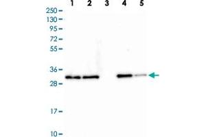 Western blot analysis of Lane 1: Human cell line RT-4 Lane 2: Human cell line U-251MG Lane 3: Human plasma Lane 4: Human liver tissue Lane 5: Human tonsil tissue with CLTA polyclonal antibody  at 1:250-1:500 dilution. (CLTA 抗体)