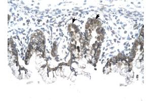 Immunohistochemistry (IHC) image for anti-Prohibitin (PHB) (C-Term) antibody (ABIN634116)