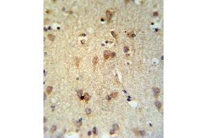 Immunohistochemistry (Paraffin-embedded Sections) (IHC (p)) image for anti-Lecithin-Cholesterol Acyltransferase (LCAT) (AA 285-313) antibody (ABIN653825)