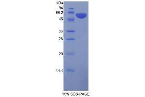 SDS-PAGE analysis of Rat Protein S Protein.