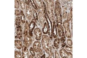 Immunohistochemical staining of human kidney with WDR23 polyclonal antibody  shows moderate to strong positivity in tubular cells at 1:20-1:50 dilution. (DCAF11 抗体)