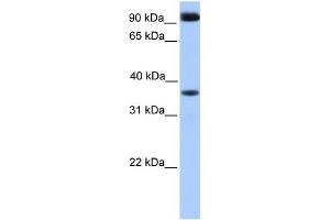 WB Suggested Anti-DCUN1D4 Antibody Titration: 0. (DCUN1D4 抗体  (Middle Region))