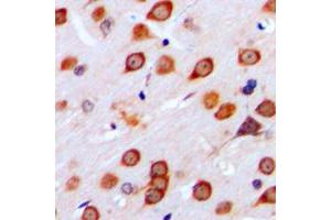 Immunohistochemical analysis of mGLUR4 staining in human brain formalin fixed paraffin embedded tissue section. (Metabotropic Glutamate Receptor 4 抗体  (C-Term))