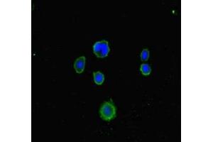Immunofluorescent analysis of MCF-7 cells using ABIN7158049 at dilution of 1:100 and Alexa Fluor 488-congugated AffiniPure Goat Anti-Rabbit IgG(H+L) (LRCH1 抗体  (AA 1-105))