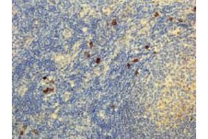 Immunohistochemical staining (Formalin-fixed paraffin-embedded sections) of human lymphoid tissue with Human IgG4 monoclonal antibody, clone RM120  under 5 ug/mL working concentration. (兔 anti-人 Immunoglobulin Heavy Constant gamma 4 (G4m Marker) (IGHG4) Antibody)