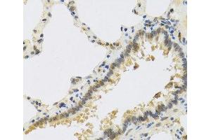 Immunohistochemistry of paraffin-embedded Rat lung using RSPO1 Polyclonal Antibody at dilution of 1:100 (40x lens). (RSPO1 抗体)