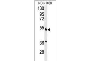 Western blot analysis of anti-HNF4A Antibody  (ABIN389268 and ABIN2839401) in NCI- cell line lysates (35 μg/lane). (HNF4A 抗体  (AA 118-146))