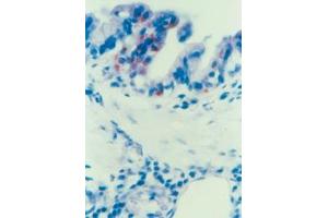 Immunohistochemical staining of Parainfluenza Typ 3 (PIV-3) in Lung epithelial cells (Guinea pig) (Parainfluenza Virus Type 3 抗体)