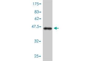 Western Blot detection against Immunogen (45. (CENPM 抗体  (AA 1-180))