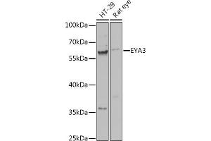 Western blot analysis of extracts of various cell lines, using EY antibody (ABIN7267073) at 1:1000 dilution. (EYA3 抗体  (AA 1-300))