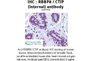 Image no. 1 for anti-Retinoblastoma Binding Protein 8 (RBBP8) (Internal Region) antibody (ABIN1738768) (Retinoblastoma Binding Protein 8 抗体  (Internal Region))