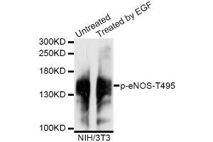 Western blot analysis of extracts of untreated and EGF-treated NIH/3T3 cells, using Phospho-eNOS-T495 antibody (ABIN5995598) at 1/1000 dilution. (ENOS 抗体  (pTyr495))