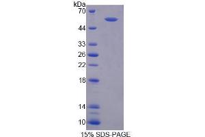 SDS-PAGE analysis of Rat RGS6 Protein. (RGS6 蛋白)