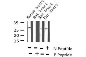 Western blot analysis of Phospho-TNNI3 (Thr142) expression in various lysates (TNNI3 抗体  (pThr143))