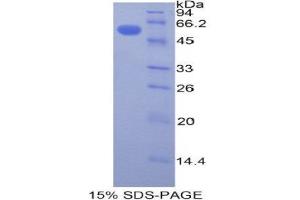 SDS-PAGE (SDS) image for Plastin 3 (PLS3) (AA 379-630) protein (His tag,GST tag) (ABIN1877311) (Plastin 3 Protein (PLS3) (AA 379-630) (His tag,GST tag))