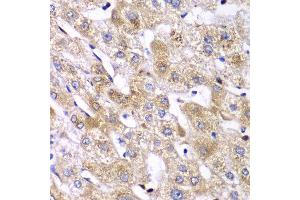Immunohistochemistry of paraffin-embedded human liver injury using RPS10 antibody at dilution of 1:100 (x40 lens). (RPS10 抗体)