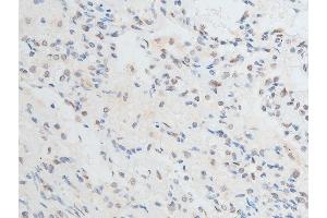 ABIN6267250 at 1/100 staining human TB tissue sections by IHC-P.