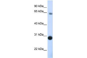 WB Suggested Anti-DERL3 Antibody Titration:  0. (Derlin-3 抗体  (C-Term))