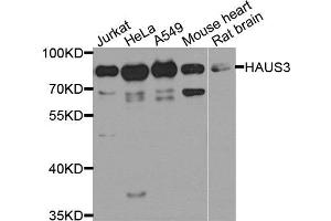 Western blot analysis of extract of various cells, using HAUS3 antibody. (HAUS3 抗体)