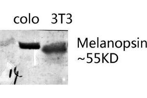 Western Blot (WB) analysis of specific lysis using Melanopsin Polyclonal Antibody. (OPN4 抗体  (C-Term))