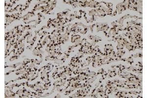 ABIN6273111 at 1/100 staining Human lung tissue by IHC-P. (DMAP1 抗体  (Internal Region))