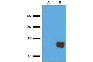 Western blotting analysis of polyclonal anti-Mycobacterium tuberculosis antigen Tb10. (Secreted ESAT-6 Like Protein ESXR (TB10.3) (ESAT-6 Like Protein 9) 抗体)