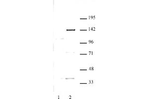 KDM4C antibody (pAb) tested by Western blot. (KDM4C 抗体)