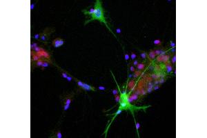 View of mixed neuron/glial cultures stained with ABIN1580409 (green) and our rabbit antibody to NeuN/FOX3 antibody (RPCA-FOX3, red). (ALDOC 抗体  (C-Term))