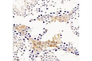 Immunohistochemistry (Paraffin-embedded Sections) (IHC (p)) image for anti-Aldehyde Dehydrogenase 4 Family, Member A1 (ALDH4A1) antibody (ABIN7073000)
