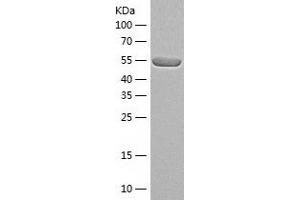 Western Blotting (WB) image for Protein Phosphatase 3, Catalytic Subunit, alpha Isoform (PPP3CA) (AA 1-511) protein (His-IF2DI Tag) (ABIN7122077)