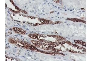 Image no. 1 for anti-phosphofructokinase, Platelet (PFKP) antibody (ABIN1500163) (PFKP 抗体)