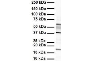 WB Suggested Anti-ZYX antibody Titration: 1 ug/mL Sample Type: Human heart (ZYX 抗体  (Middle Region))