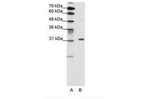 Image no. 1 for anti-Chromobox Homolog 1 (CBX1) (AA 61-110) antibody (ABIN202048) (CBX1 抗体  (AA 61-110))
