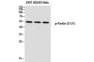 Western Blot (WB) analysis of 293T AD293 HeLa using p-Parkin (S131) antibody. (Parkin 抗体  (pSer131))