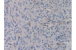 Used in DAB staining on fromalin fixed paraffin- embedded liver tissue (Integrin beta 3 抗体  (AA 134-376))