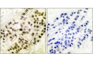 Immunohistochemistry (Paraffin-embedded Sections) (IHC (p)) image for anti-Cyclin B1 (CCNB1) (AA 91-140) antibody (ABIN2888597) (Cyclin B1 抗体  (AA 91-140))