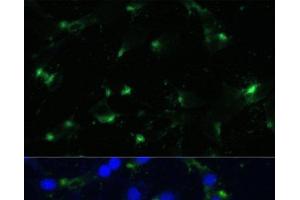 Immunofluorescence analysis of NIH-3T3 cells using ENO1 Polyclonal Antibody at dilution of 1:100. (ENO1 抗体)