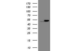 Image no. 1 for anti-Epoxide Hydrolase 1, Microsomal (Xenobiotic) (EPHX1) (AA 21-230) antibody (ABIN1491195) (EPHX1 抗体  (AA 21-230))