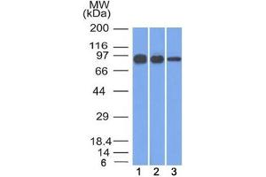 Western blot testing of human 1) A431, 2) A549 and 3) MCF7 cell lysate with Beta Catenin antibody (clone 12F7).