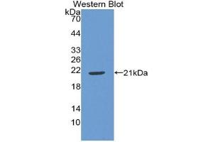 Detection of Recombinant IL22, Human using Polyclonal Antibody to Interleukin 22 (IL22) (IL-22 抗体  (AA 34-179))