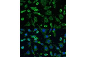 Immunofluorescence analysis of L-929 cells using SPARC Polyclonal Antibody (ABIN7270183) at dilution of 1:100 (40x lens). (SPARC 抗体  (AA 18-303))