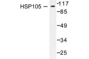Image no. 2 for anti-Heat Shock 105kDa/110kDa Protein 1 (HSPH1) antibody (ABIN265469) (HSPH1 抗体)