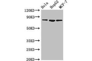 Western Blot Positive WB detected in: Hela whole cell lysate, HepG2 whole cell lysate, MCF-7 whole cell lysate All lanes: IMMT antibody at 3. (IMMT 抗体  (AA 76-215))